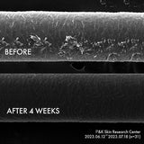 ProtoClinical k-beauty LABO-H Scalp Strengthening Clinic Capsule Treatment Hair Loss Care 220ml shown in a black and white before-and-after close-up of damaged hair texture after 4 weeks